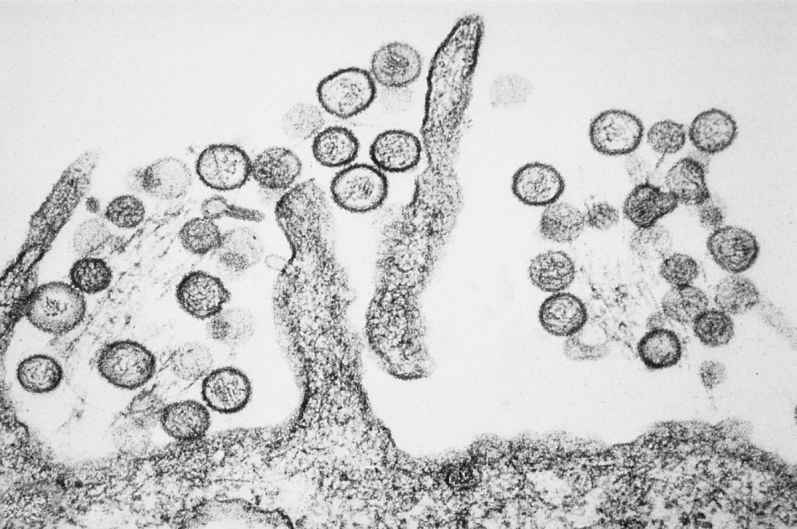 EU Agency Finds No Indication of Hantavirus Mutation After Cruise Ship Outbreak