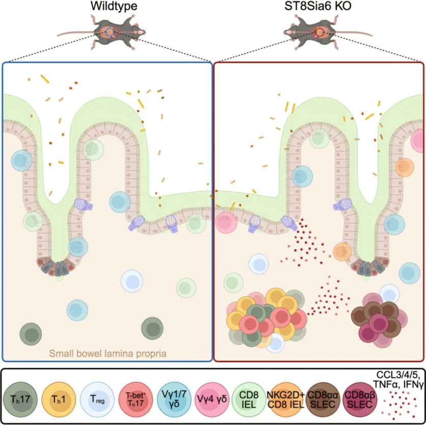 Researchers Discover Molecule Linked to Treatment-Resistant Inflammatory Bowel Disease
