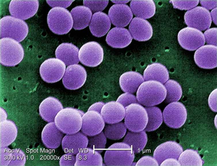 Friendly Skin Bacteria Could Help Treat Eczema