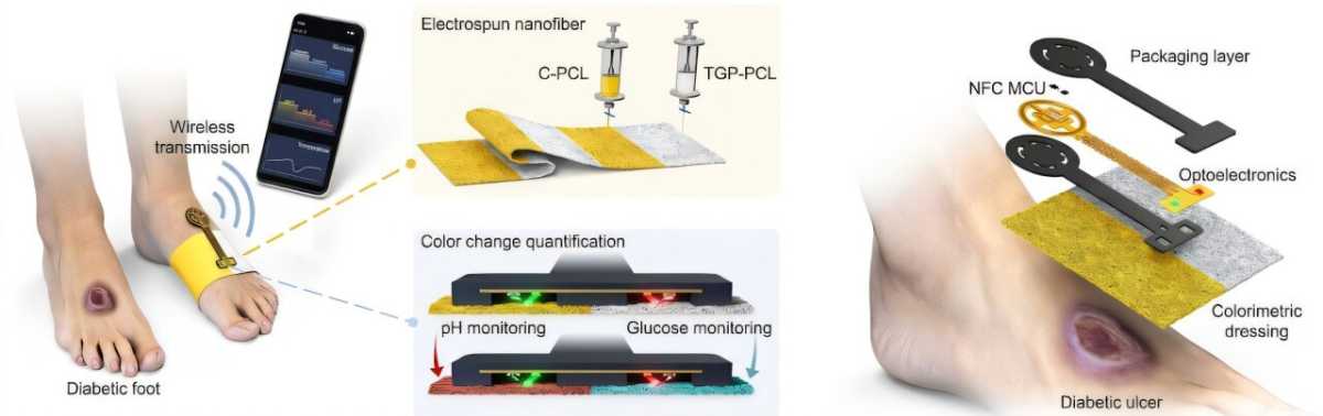 Real-time Diagnostic Smart Dressing Patch Could End Fear of Diabetic Foot Amputation