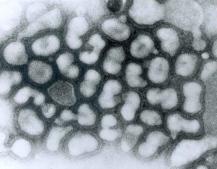 Immune System Overreaction Linked to Deadly Flu in Pregnancy