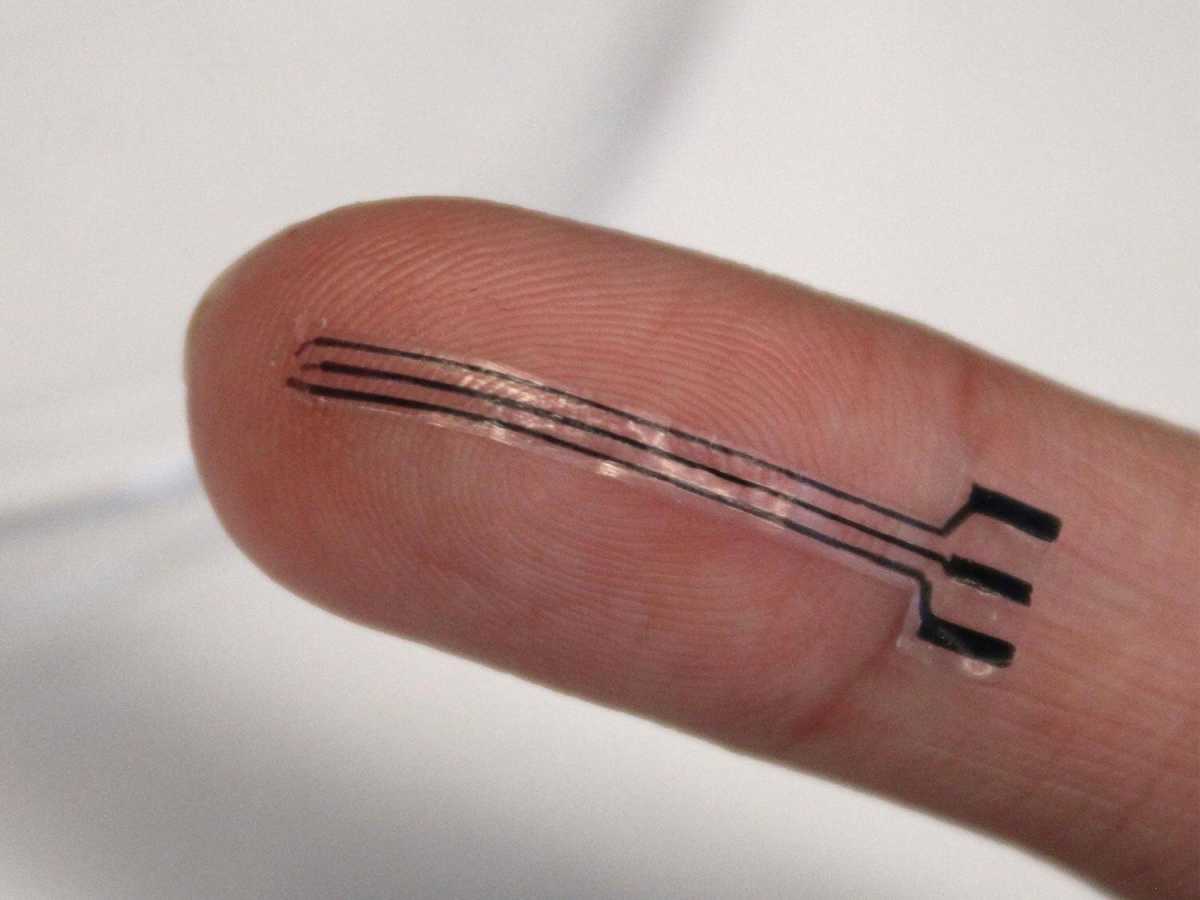 Stretchy Implants Could Treat High Blood Pressure