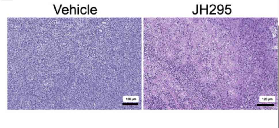 Study Reveals Promising New Therapy for Non-Hodgkin Lymphoma