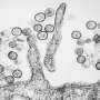 Canada Cruise Passenger Presumptive Positive for Hantavirus