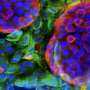 A Protective Gel for Type 1 Diabetes Treatment