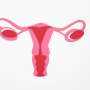 Why has PCOS been given a new name?