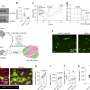 A new way to recharge aging muscle stem cells by restoring a key metabolic component