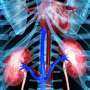 New-onset A-Fib May Accelerate Kidney Function Decline