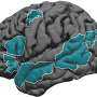 By Age 4, One Side of Brain Takes Charge in Language Processing