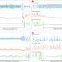 Innovative Smart Wristband Technology May Revolutionize Cardiac Arrest Detection and Response