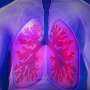 Study Finds Private Equity-Owned Hospitals Have Poorer Outcomes for Lung Conditions
