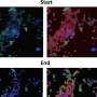 Protecting the Brain: Protein Clumps May Serve as Vital Defense Mechanism