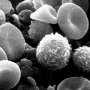 Study identifies key protein in immune cell exhaustion in cancer immunotherapy