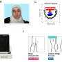 Tracking tiny facial movements could offer a more objective way to measure pain