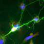 Brain's Chemical Brake Hides a Second Power, Shaping Mental Disorder Treatments