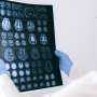Cytokine-Armored CAR-T Cell Therapy Boosts Immune Attack on Aggressive Brain Tumors