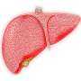 Study Illuminates Link Between Fatty Liver Disease and Cardiovascular Events