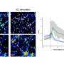 How schizophrenia risk may begin: Gene changes reshape signaling in developing neurons