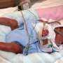 Rewiring Early Life: What Extremely Preterm Birth Teaches Us About the Brain