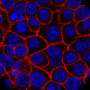 Adding a lower cutoff value for CA19-9 may identify additional high-risk cases of pancreatic cancer