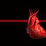 AI unlocks cardiac MRI reading without manual labels, beating general models by 35%