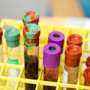 New marker identifies patients with advanced prostate cancer more likely to benefit from combination immunotherapy