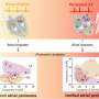 Both Heart Chambers Affected More Severely in Persistent Atrial Fibrillation Study Finds