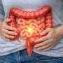 Targeting inflammation may help overcome drug resistance in colon cancer