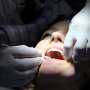 Stem Cells at Root of Tooth Aging Point to Potential Treatments