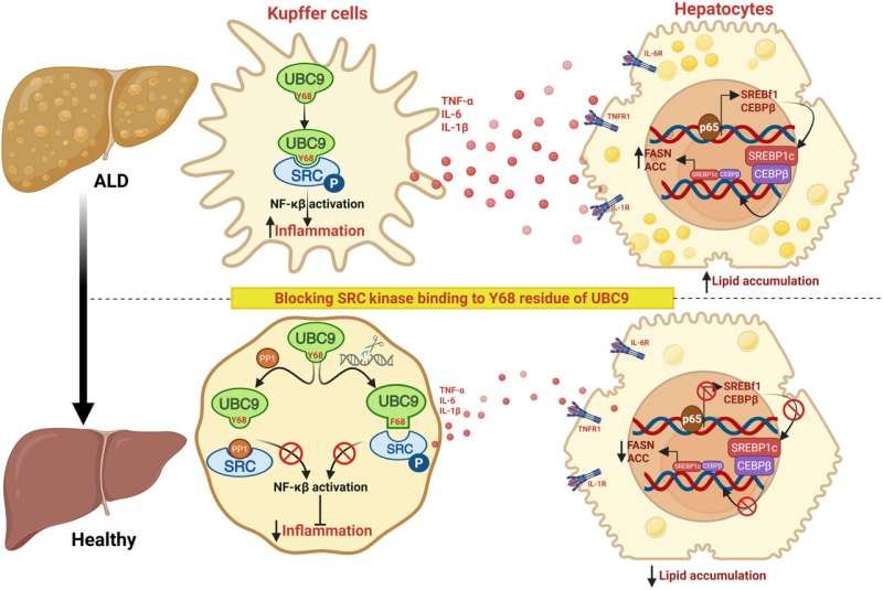 Molecular Pathways Behind Inflammation in Alcohol-Associated Liver Disease Uncovered