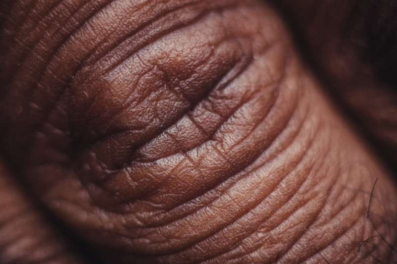 Dermatologists and oncologists call for overhaul of widely used cancer side-effect grading system