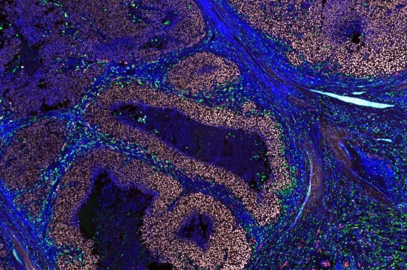 Scientists capture 'housekeeping' immune cells attacking live melanoma