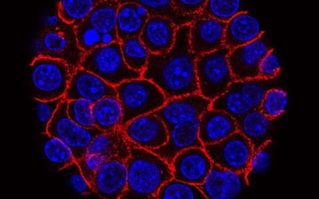 Adding a lower cutoff value for CA19-9 may identify additional high-risk cases of pancreatic cancer