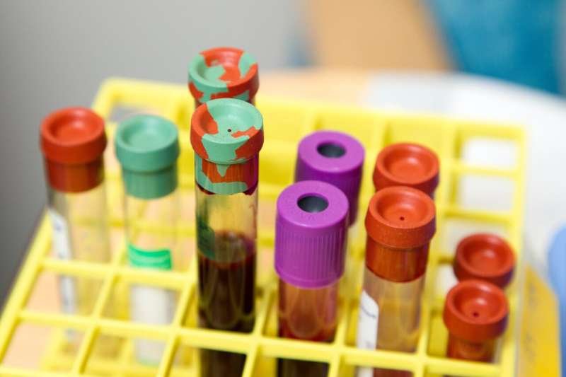 New marker identifies patients with advanced prostate cancer more likely to benefit from combination immunotherapy