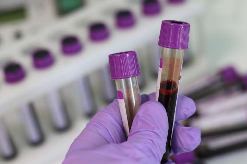 New Approach Could Lead to Earlier Diagnosis of Iron Deficiency in School-Aged Children