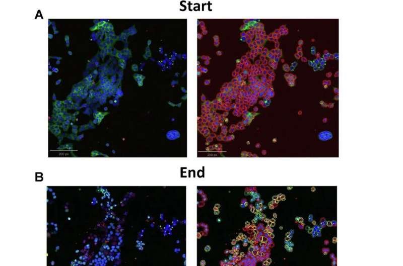 Protecting the Brain: Protein Clumps May Serve as Vital Defense Mechanism