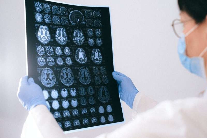 Cytokine-Armored CAR-T Cell Therapy Boosts Immune Attack on Aggressive Brain Tumors