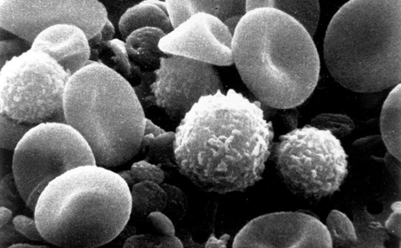Study identifies key protein in immune cell exhaustion in cancer immunotherapy