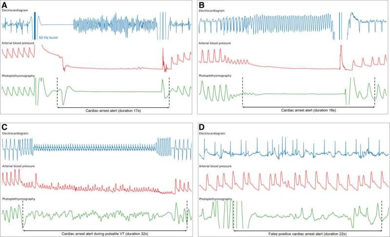 Innovative Smart Wristband Technology May Revolutionize Cardiac Arrest Detection and Response