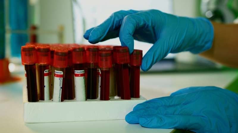 Reversing T Cell Exhaustion Improves Myeloma Immunotherapy Effectiveness