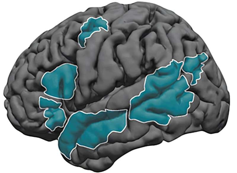 By Age 4, One Side of Brain Takes Charge in Language Processing