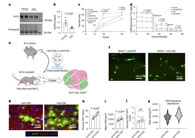 A new way to recharge aging muscle stem cells by restoring a key metabolic component