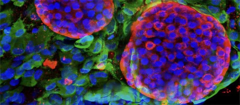 A Protective Gel for Type 1 Diabetes Treatment