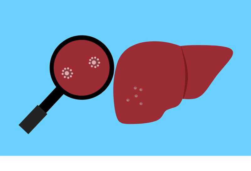 Chronic liver disease in Europe: A preventable crisis going undetected