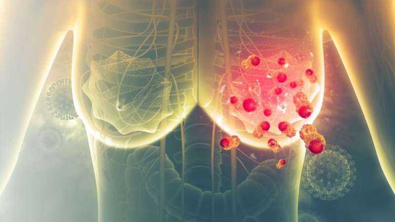 FDA approves Enhertu as neoadjuvant, adjuvant treatment for breast cancer