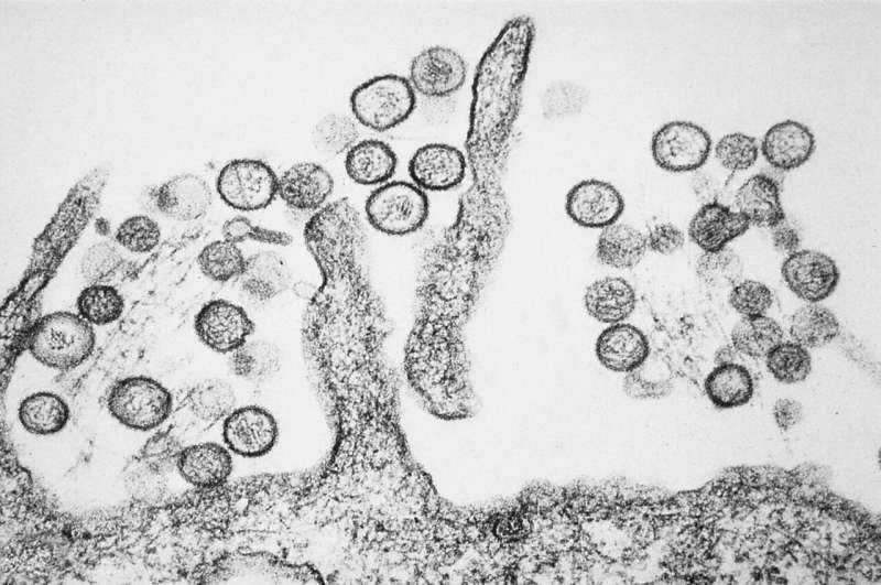 Quarantined Spaniard tests positive for hantavirus: Health ministry