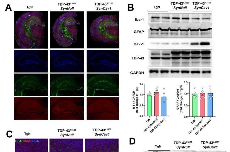 Experimental Gene Therapy May Shield Brain from Toxic Protein Damage Linked to Neurodegeneration