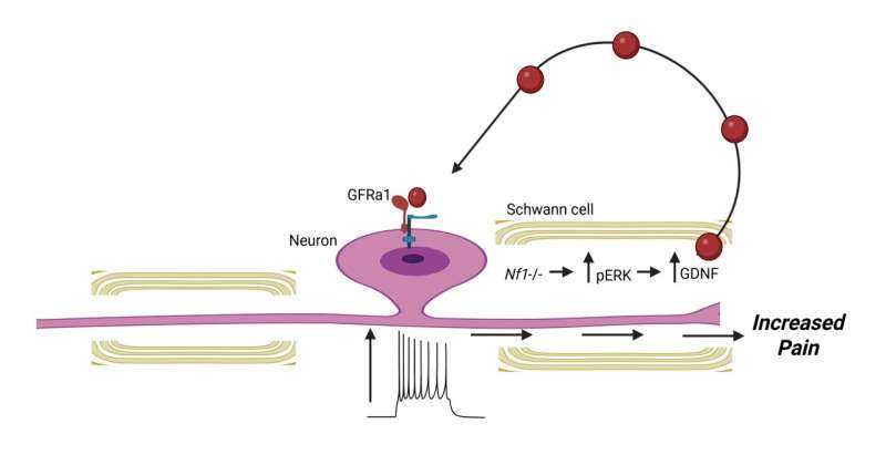 Schwann cells may trigger NF1 pain before tumors appear, mouse study suggests