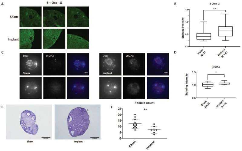 Oral Inflammation May Speed Fertility Decline, Mouse Study Suggests