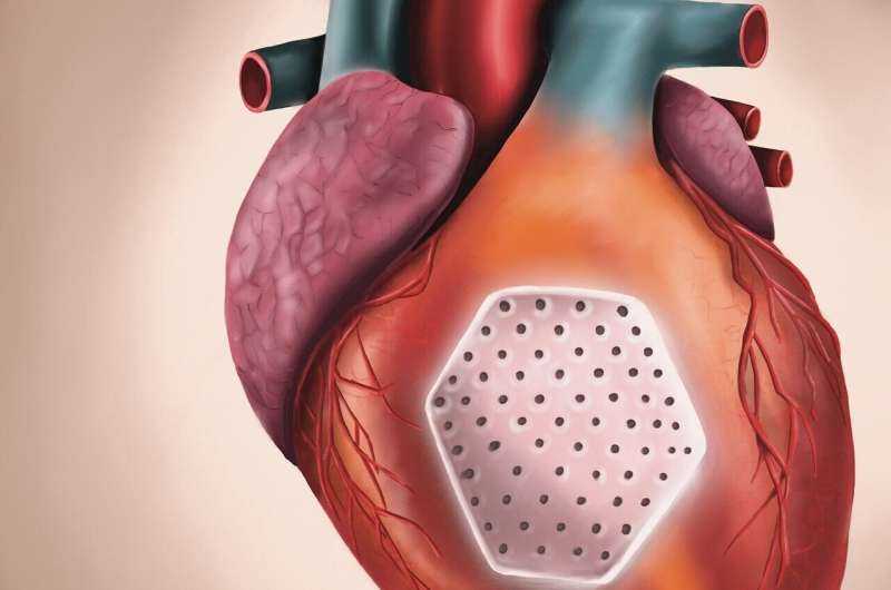Lab-Grown Heart Patch Shows Promise in Severe Heart Failure Trial